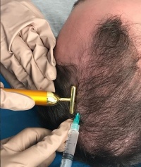 klinikatazbir